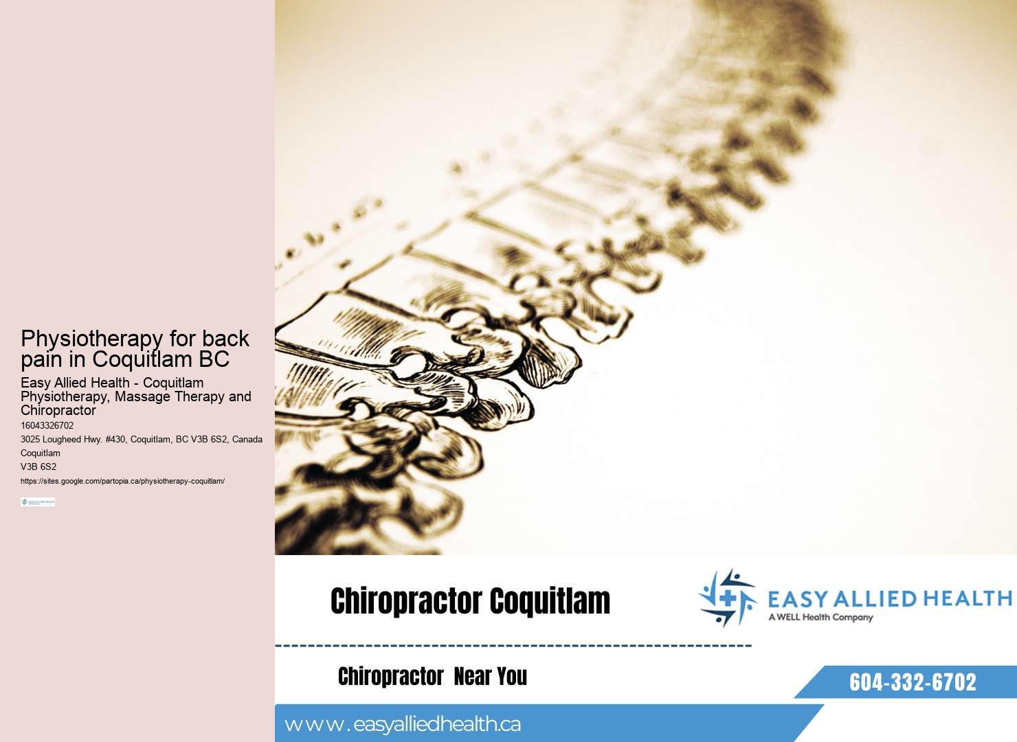 Workplace ergonomics Physiotherapy Coquitlam