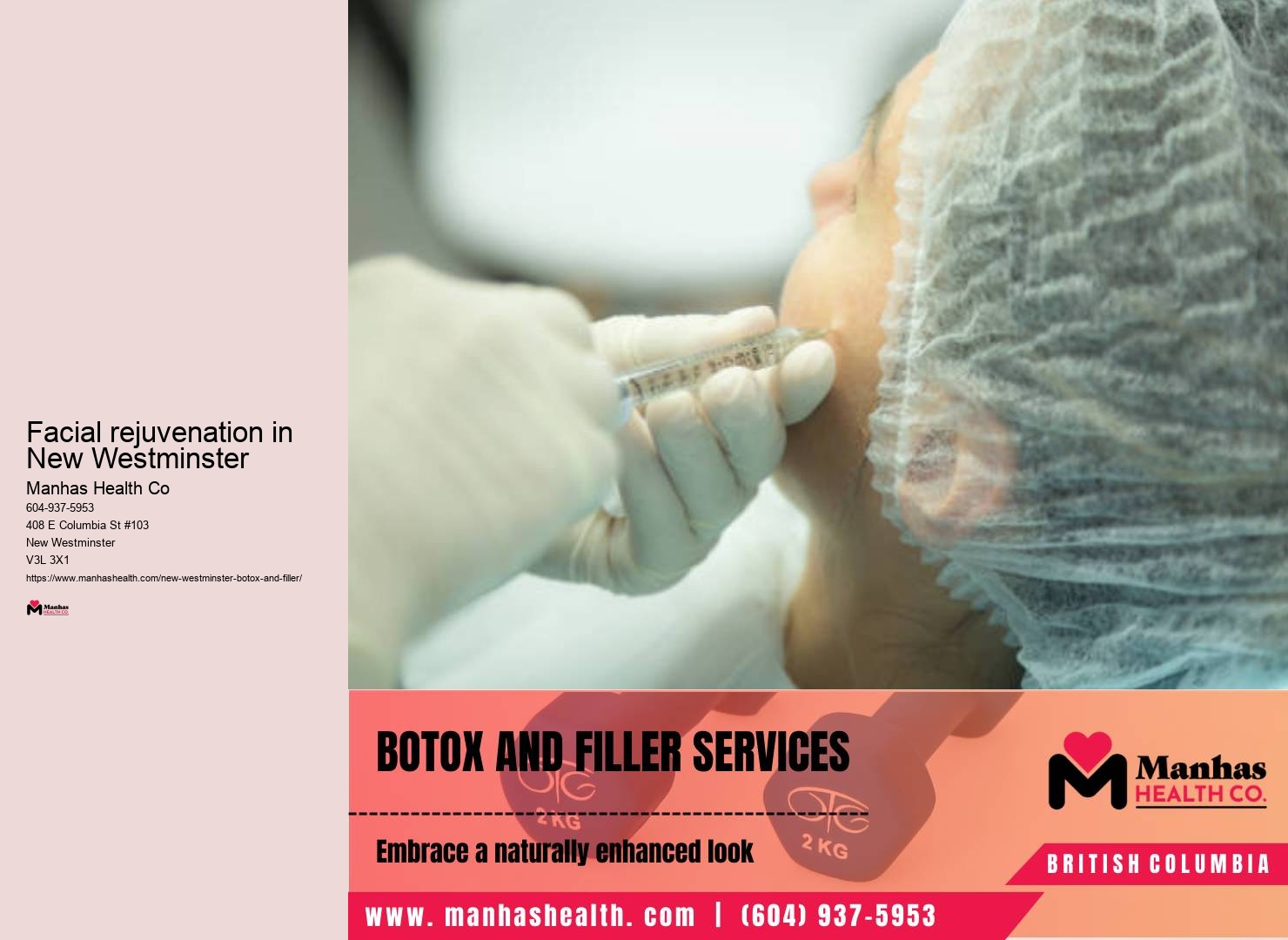 Botox for Perioral Lines in New Westminster