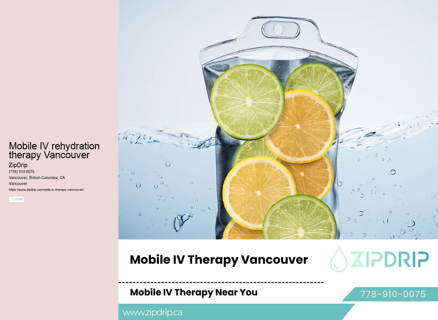 Mobile vitamin infusion Mobile IV rehydration therapy Vancouver
